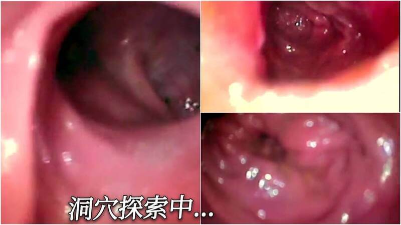 内窥镜下肉肉的粉嫩诱惑，欧美虐肛快感体验！