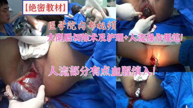 暗网硬核医疗黑料曝光，女性私密整形手术全过程流出，大阴唇修剪重塑加人流手术实录。