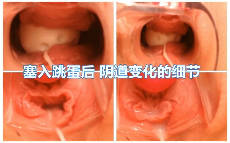 近距离窥视淫荡少妇，内窥镜下阴道跳蛋高清特写，白浆四溢流淌不停。