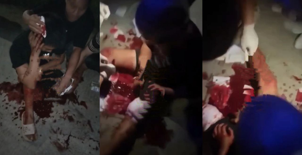 广东省吴川市发生惨烈砍人事件 伤者遍体鳞伤浑身是血 画面血腥胆小勿入