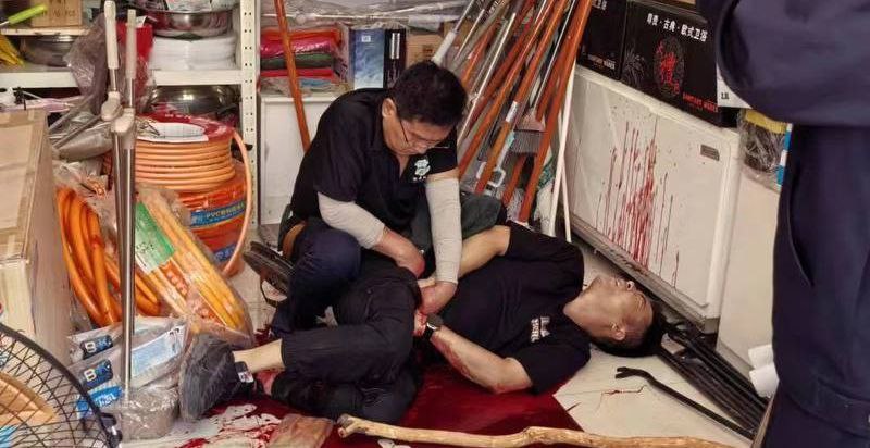 山东临清 肥螺叔叔老板因螺蛳粉太臭等纠纷 被五金店老板捅伤阴茎和阴囊 难道里面加屎了吗