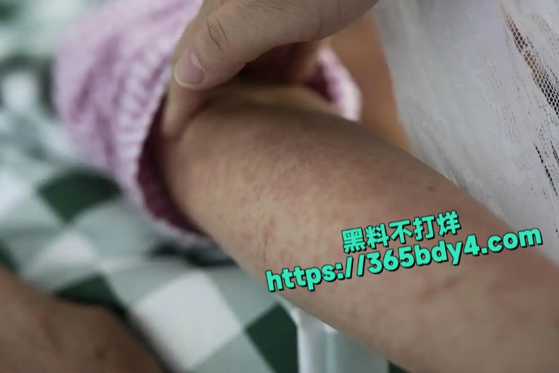 广东乐从镇针对基孔肯雅热4