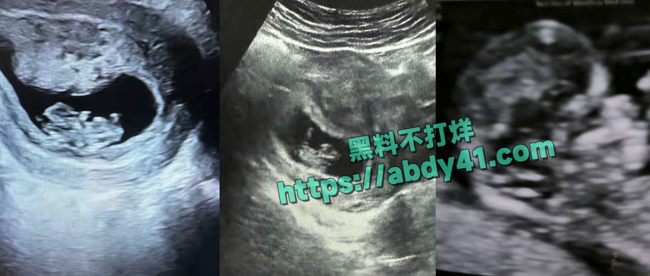 书释晋丞家暴事件 23