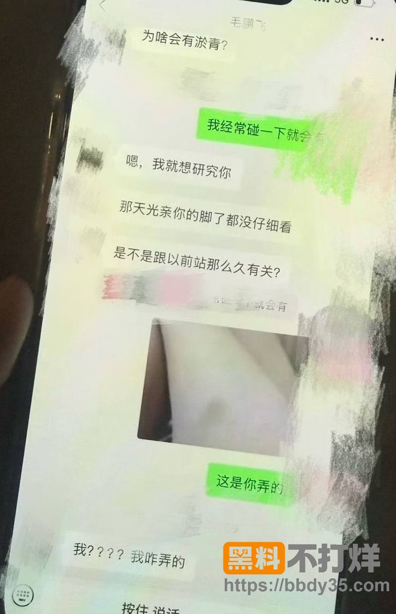 爆料21