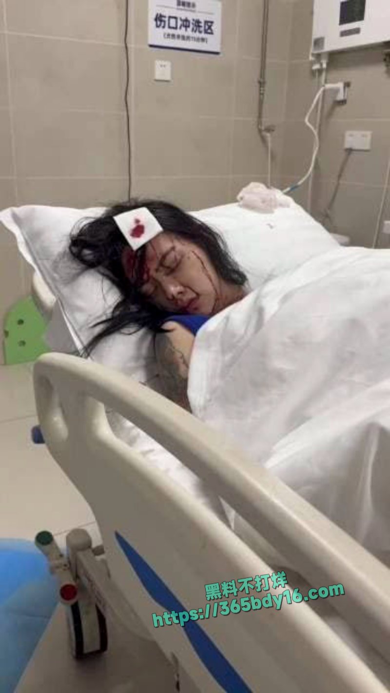 自己酒后和闺蜜发生争执引的闺蜜持刀将自己砍伤 14