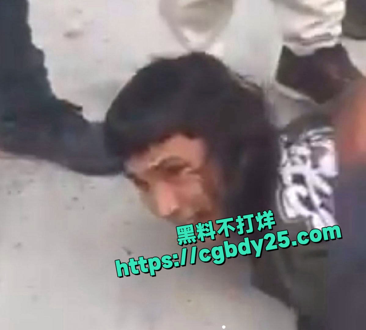 哥伦比亚总统候选人遭枪击5