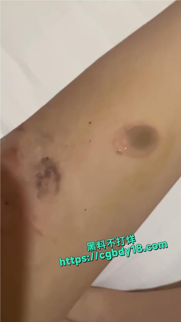 亚太第一深情自残4