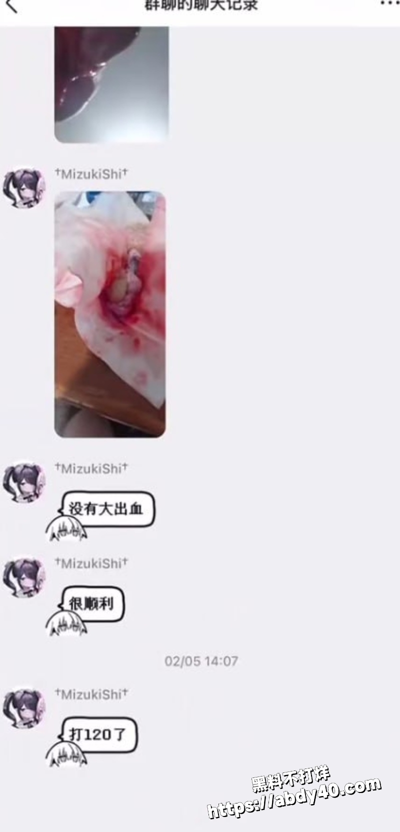 雷霆自残割蛋蛋10