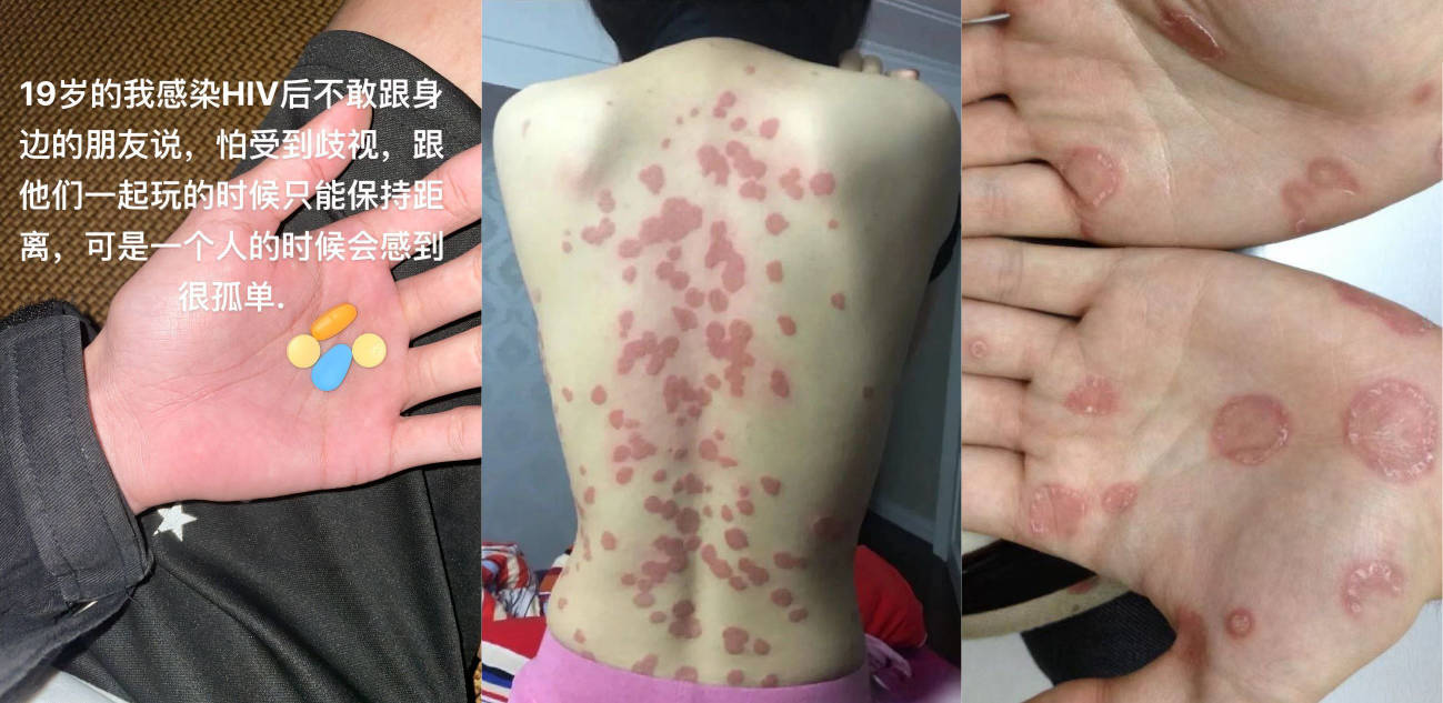 国服镜 抖音寂寞的海 线下操粉遇到生化母体 艾滋梅毒淋病加hpv四合一 线下被单杀！