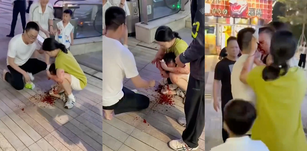 深圳初中生骑自行车速降撞到小孩 伤者瞬间磕得满头是血 监控记录现场惊险一幕