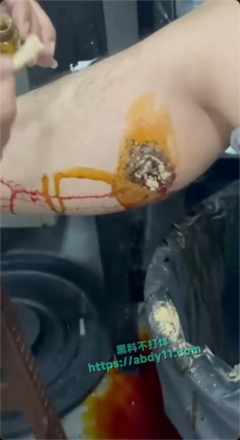 缅甸妙瓦底顺达园区惨案 13