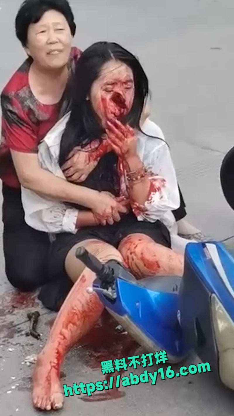 小姐姐骑电动车发生意外 1