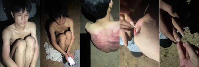 【独家曝光】江西小伙因百万年薪诱惑 被骗至缅北 因无钱赎身被疯狂折磨
