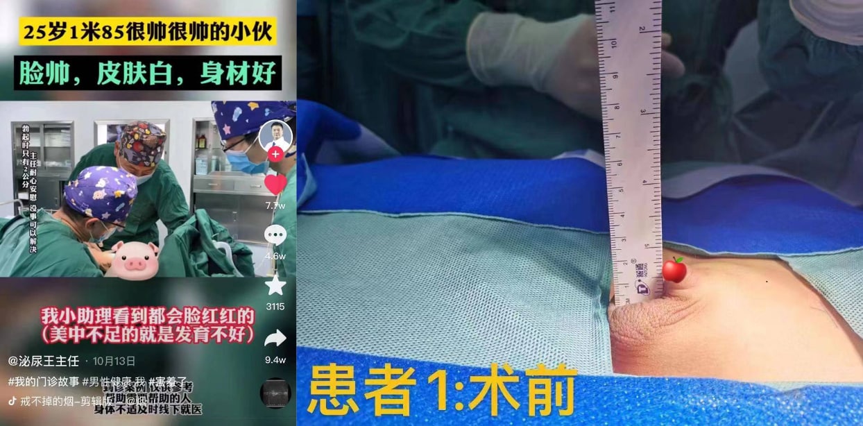 抖音爆梗-25岁帅气小伙原视频照片流出