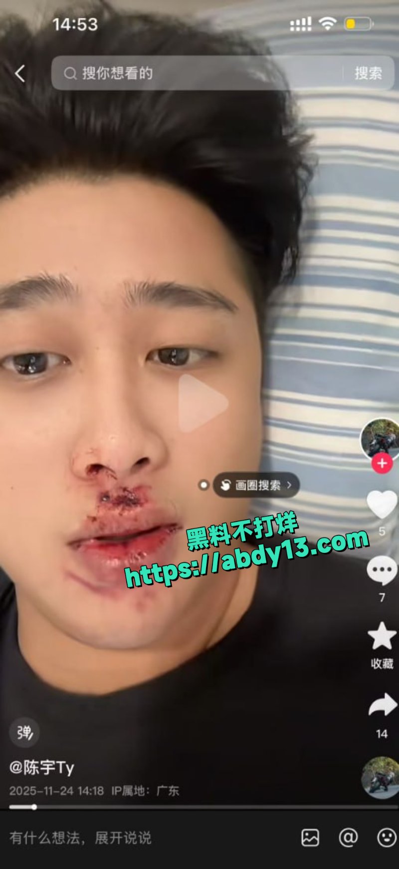 网红袁聪摩托骑手出事故8