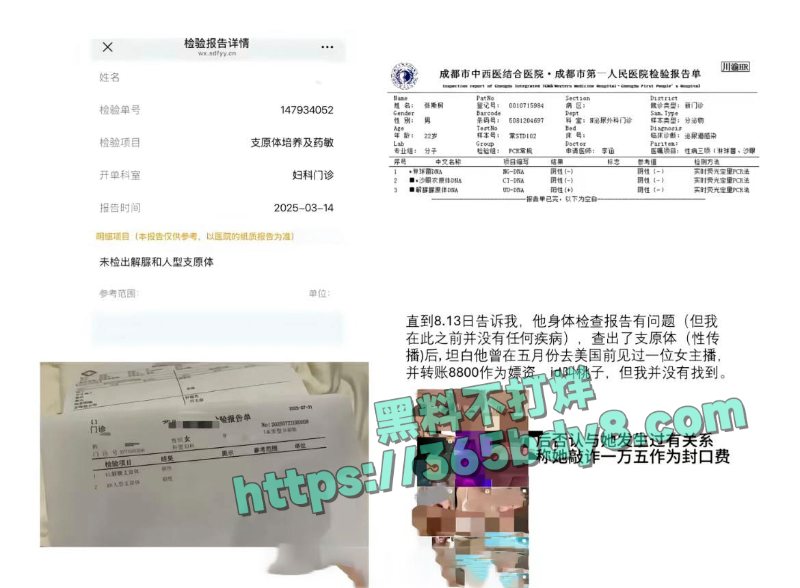 张斯柯出轨嫖娼 19