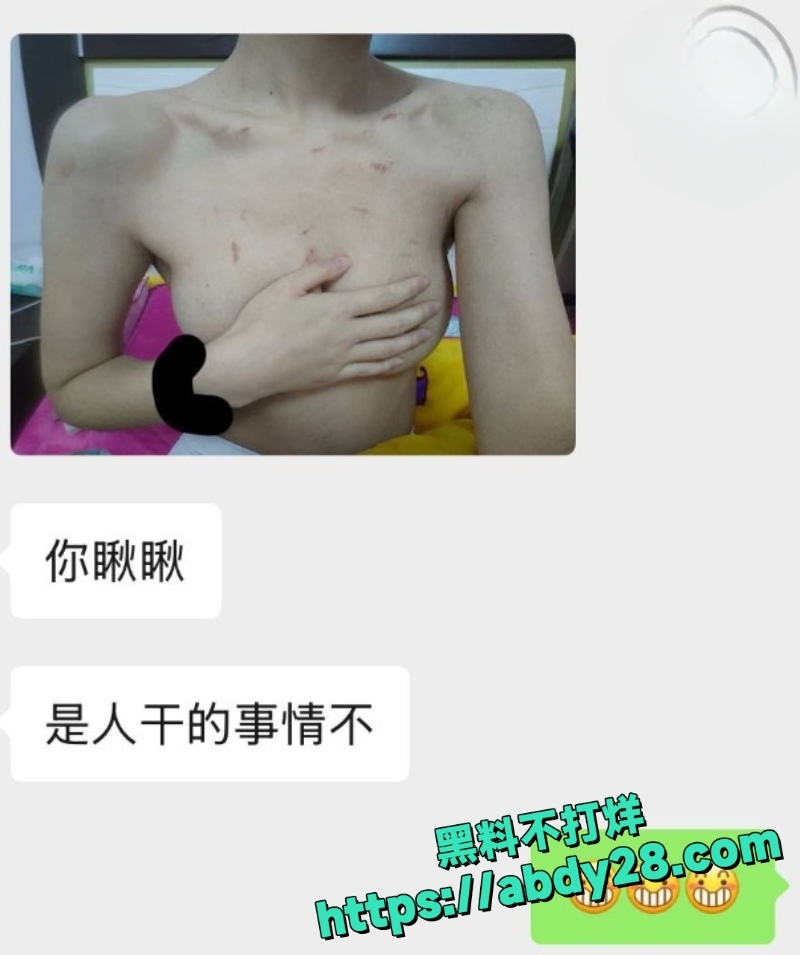 海角精选纯爱藏黄刀贴1