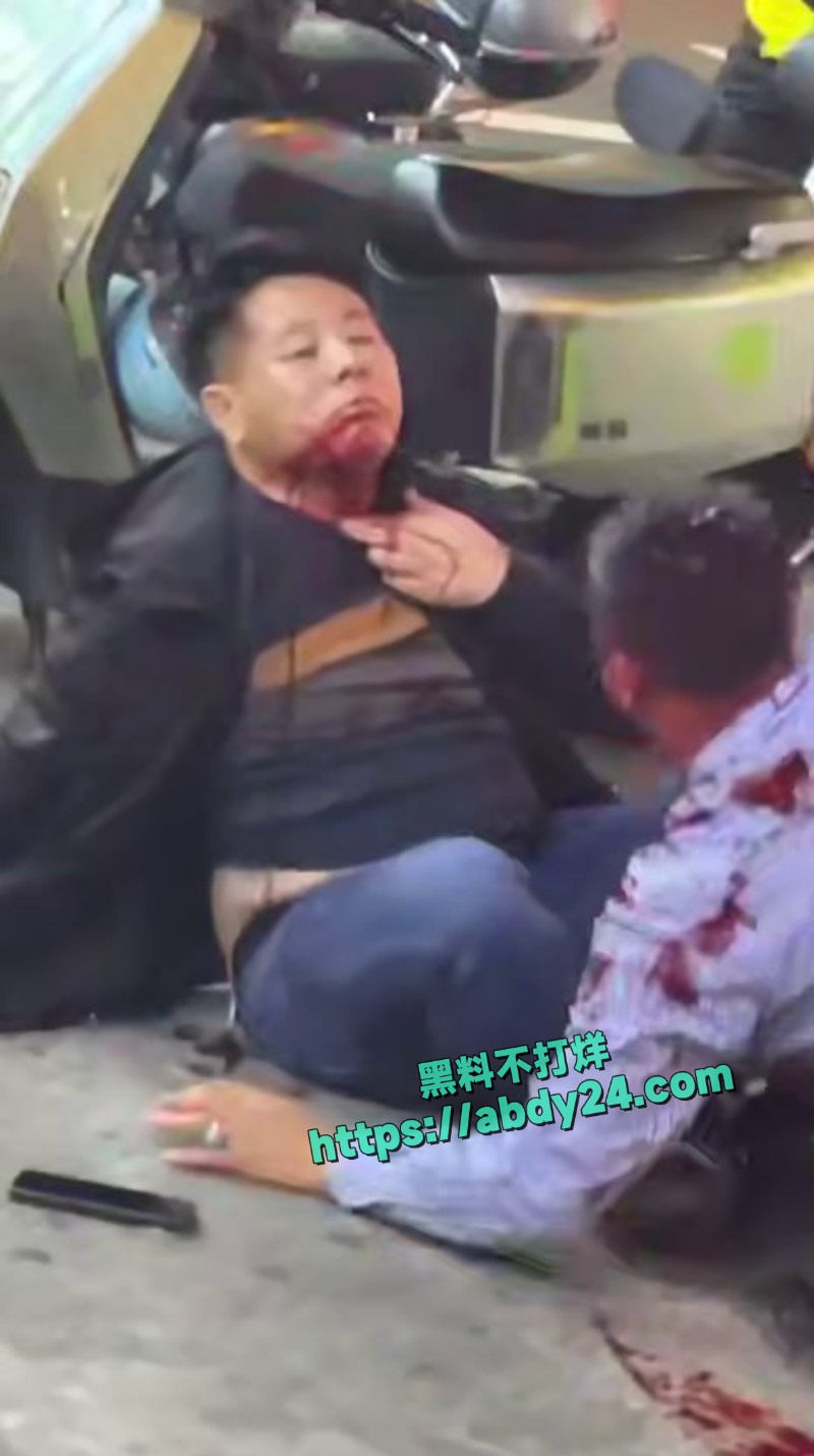 街头两男子倒地头破血流4