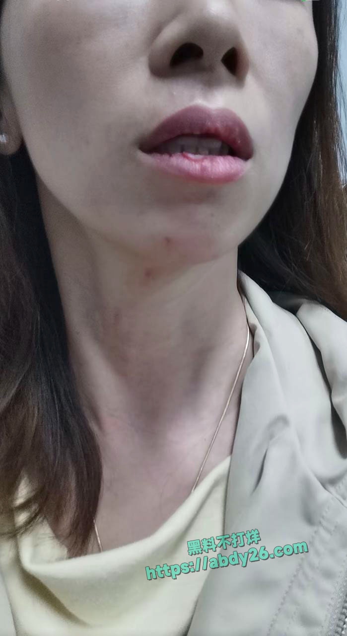娜姐重生揭露丈夫出轨家暴 44