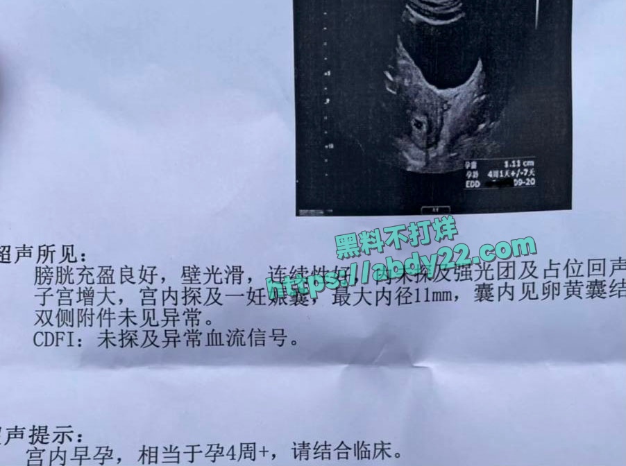 娱乐圈当家花旦李沁被爆私生活混乱 19