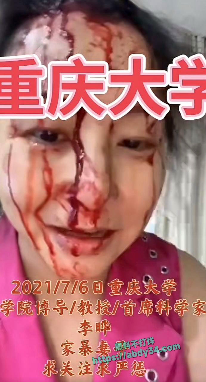 李晔殴打妻子2