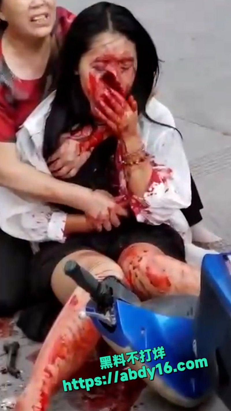 小姐姐骑电动车发生意外 3
