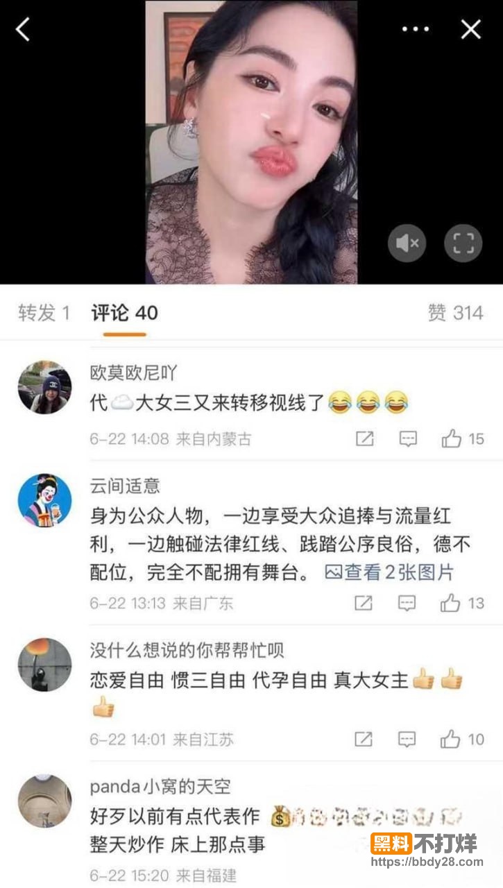 张雨绮5