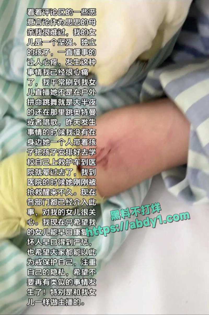 湖南女主播思思收到神秘炸弹快递遭严重炸伤面部毁容 3