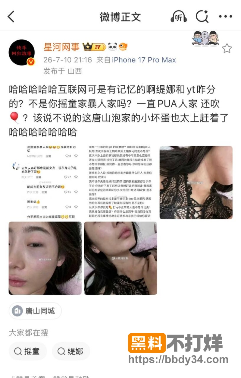 摇童 1