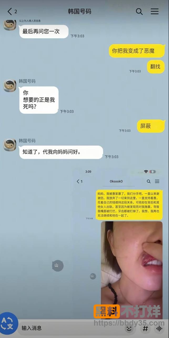 爆料21