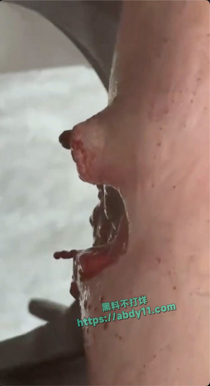 缅甸妙瓦底顺达园区惨案 14