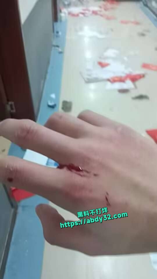山东环帝网瘾戒除学校学生暴动  9
