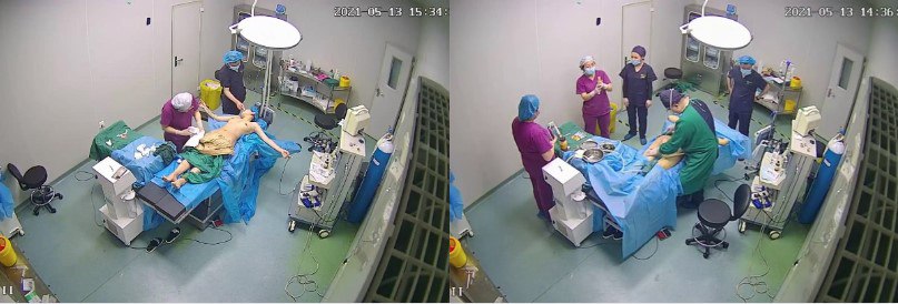 摄像头破解 某整形医院 妹子脱光光做抽脂 麻醉过后疼的哭懵了圈