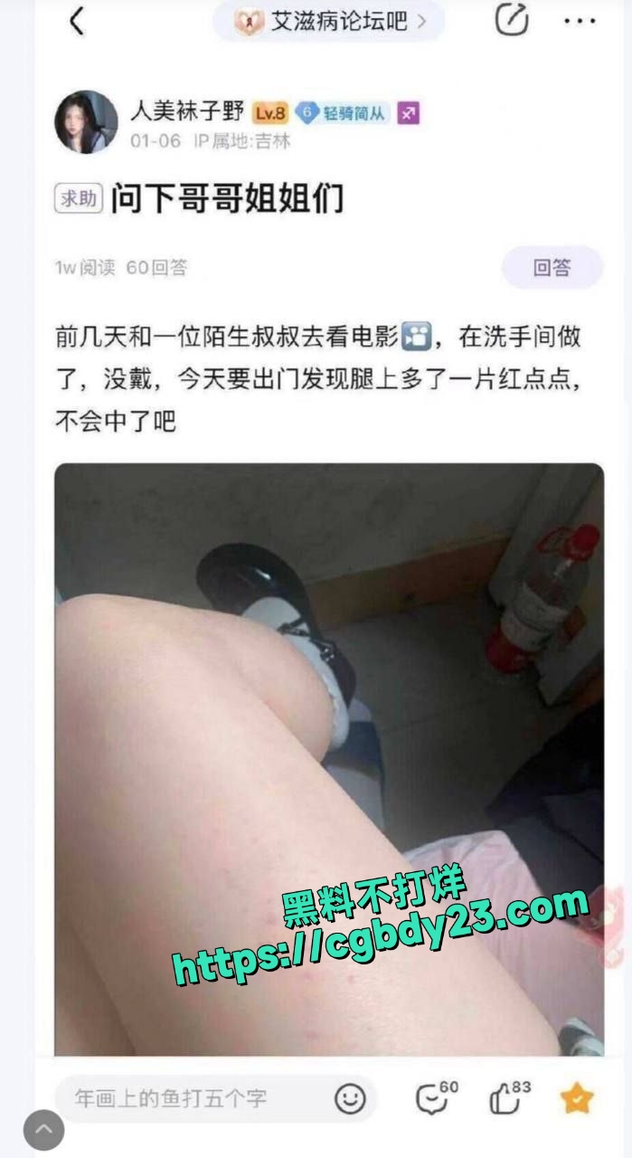 艾滋病贴吧3