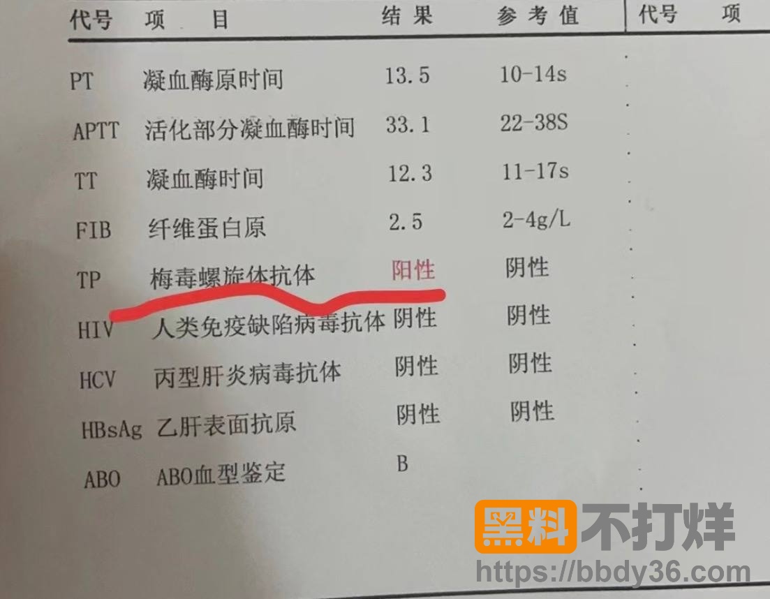爆料4