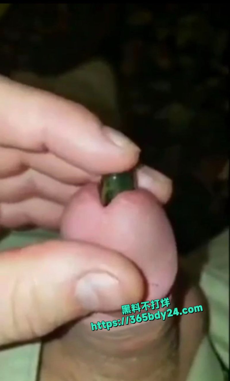 血蛭往龟头里塞2