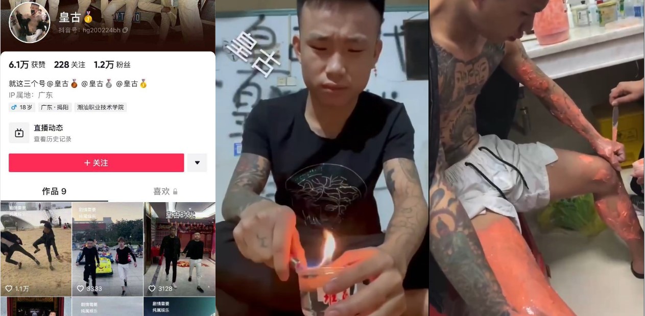 抖音 精神小伙 皇古 直播装逼失败裤裆着火 希望老二还能保住