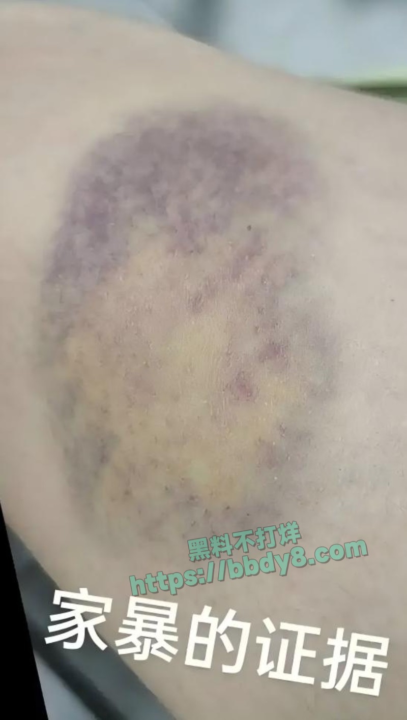 前国足队员孙吉家暴出轨26