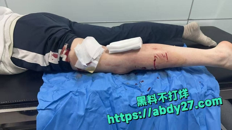 路过姐妹被疯狗追咬事件1