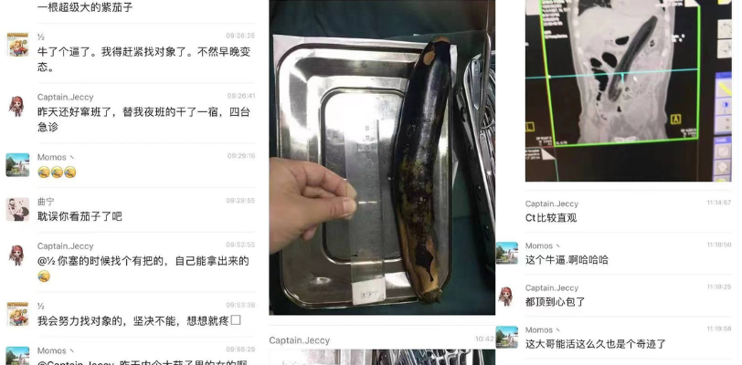 50岁了还玩这么花！大爷为寻求刺激，将30cm茄子插入肛门 无法取出 医护人员都惊呆