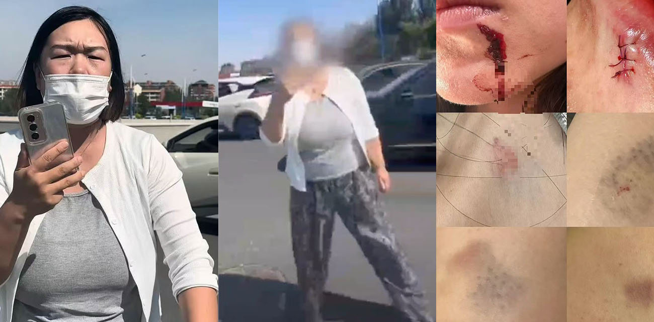 内蒙古呼和浩特白衣女子打人事件 开车插队截停后车爆发口角 还主动拍下视频倒打一耙