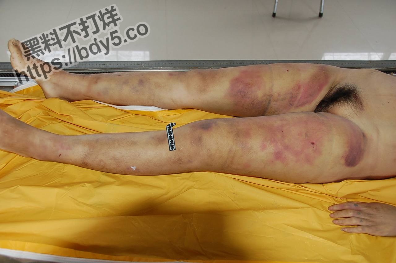 胆小慎入绝密档案之医院太平间.jpg