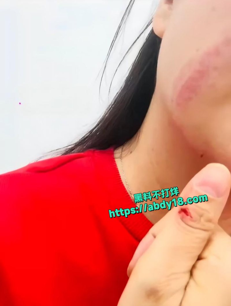 三亚女子被打5