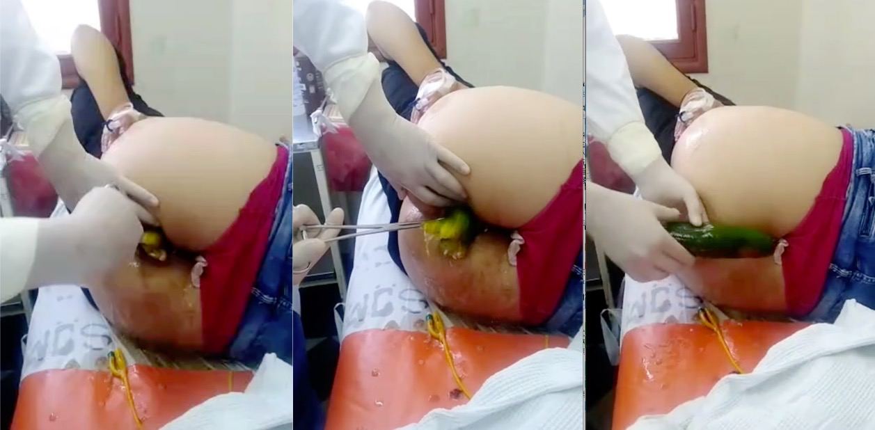 （重口味的进来 ）美女黄瓜深入去医院做手术取出