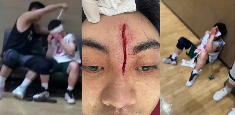 广州汇悦台一男子球品太差拿球爆头对方！额头上鲜血直流，这一肘击直接干芭比Q了！