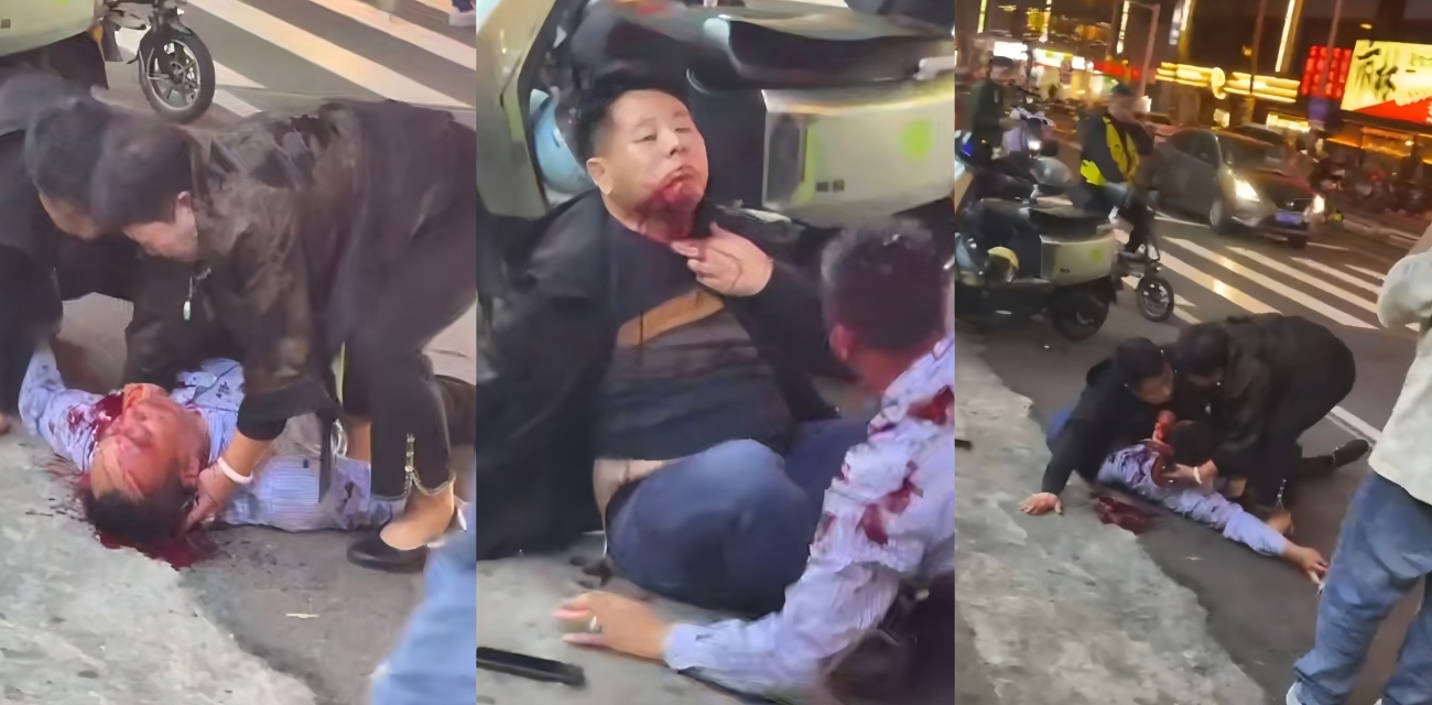 街头惊现血腥一幕 俩男人倒地头破血流 血流一地分不清是谁的 太吓人了