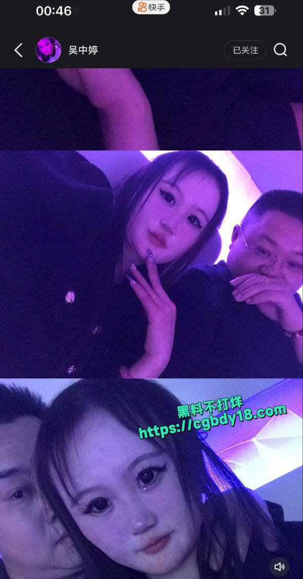 成都吴思婷 身上有病不说 长得也像生化人9
