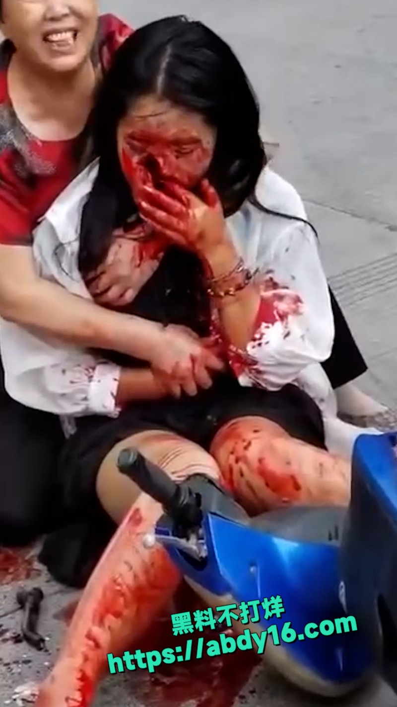 小姐姐骑电动车发生意外 4
