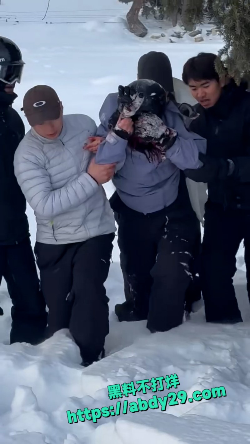 新疆可可托海发生雪豹伤人事件 18