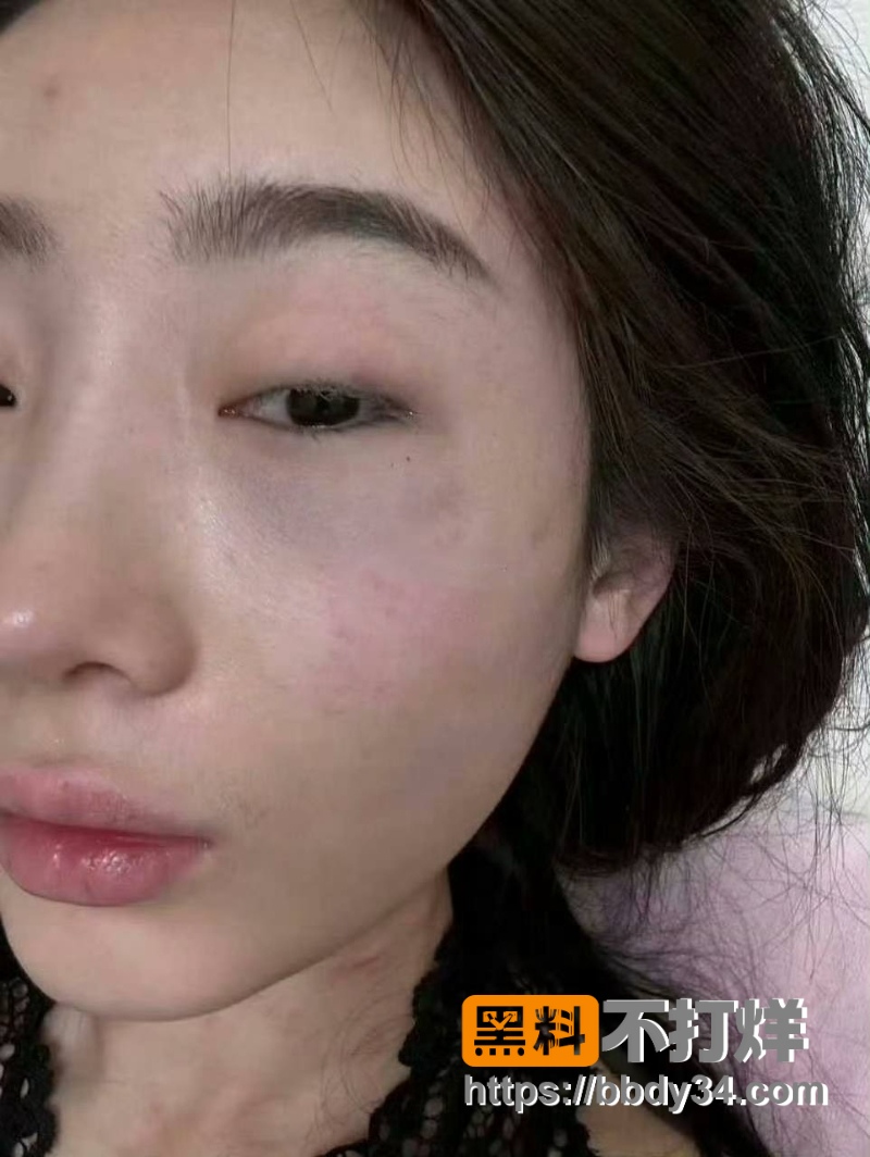 摇童 10